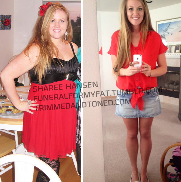 70 Pound Weight Loss Transformation Women With Moustaches
