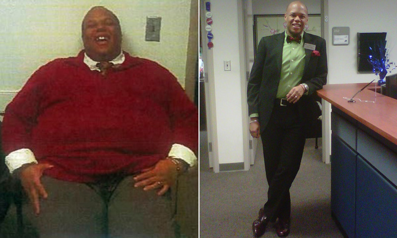 250 Lbs Weight Loss