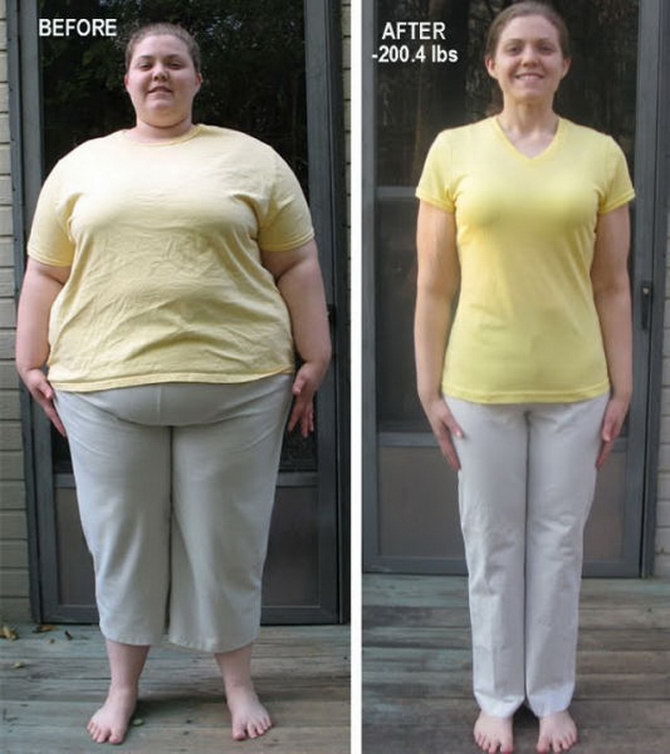 20 Amazing Weight Loss Transformations Losing Over 100lbs!