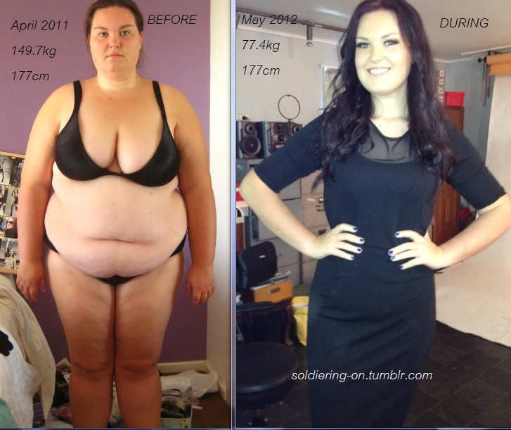 Amazing Weight Loss Transformations Women Gender