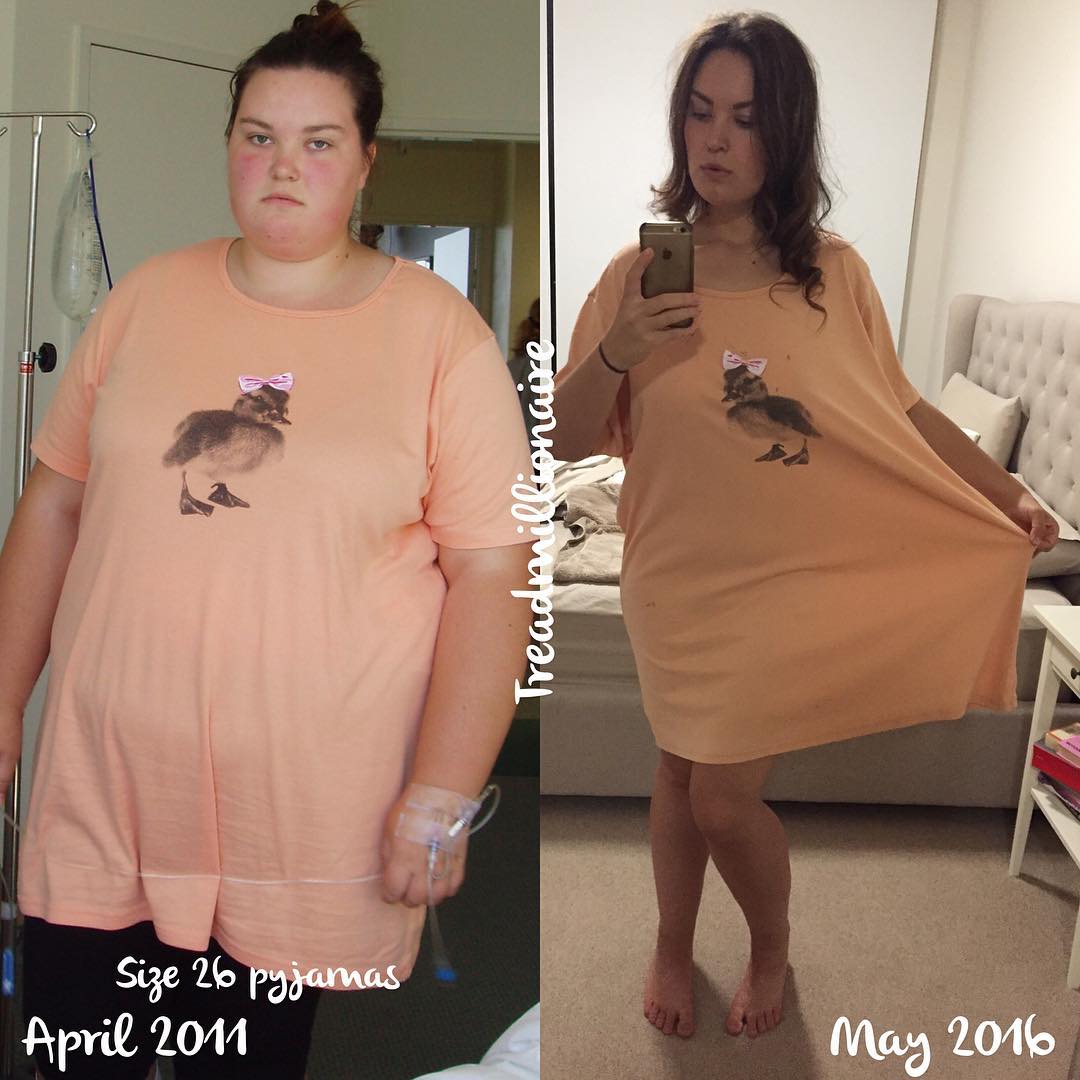 Jessica Davis aka Treadmillionaire Lost 75Kgs - Over Half Her Body Weight!