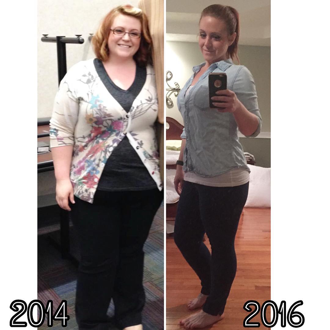 Amy LeRoy Went From A Morbidly Obese 350lbs To Losing Over 200lbs!