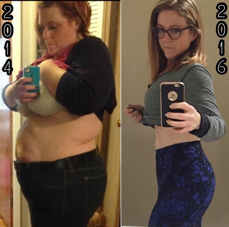 Amy LeRoy Went From A Morbidly Obese 350lbs To Losing Over 200lbs!