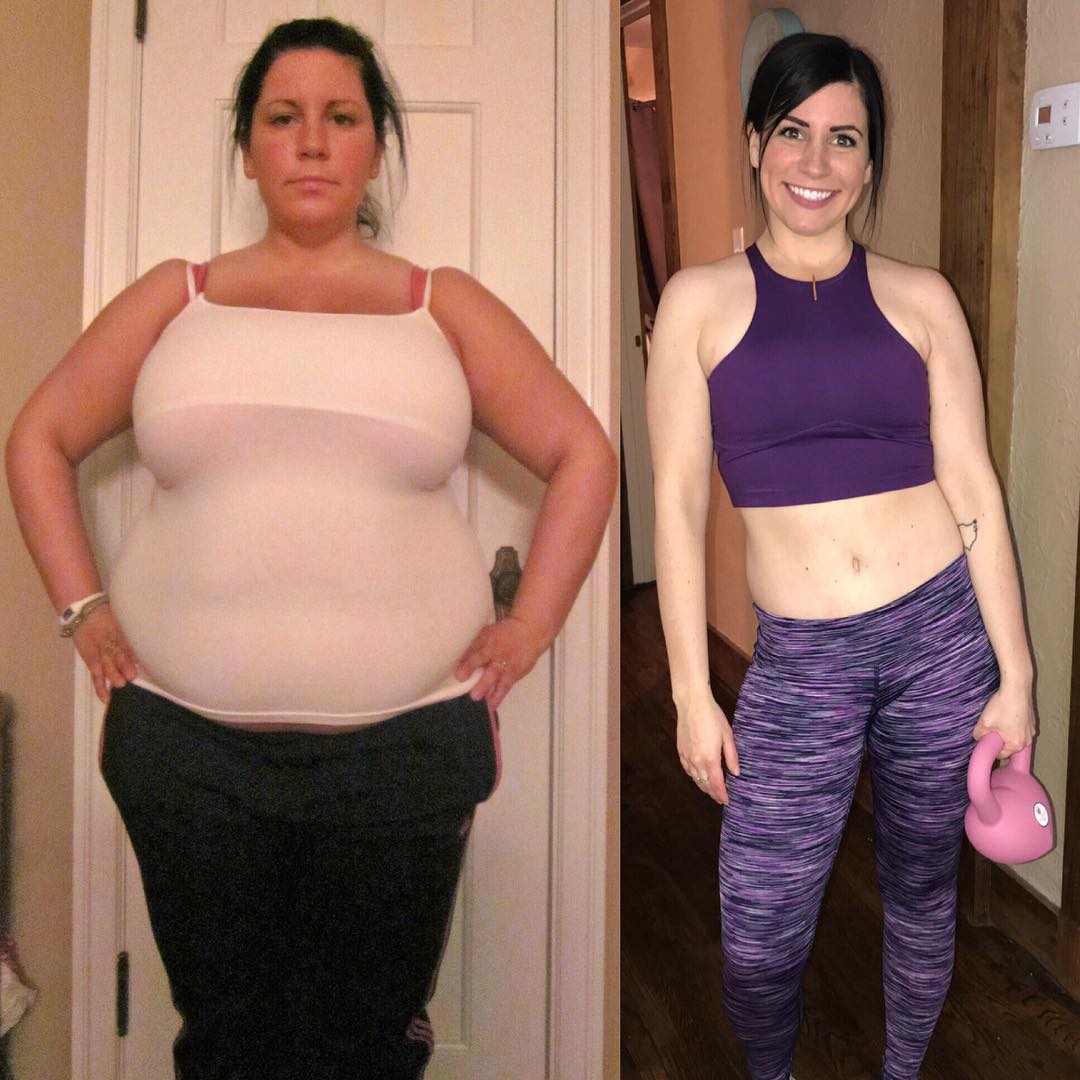 Belly Weight-Loss Transformations