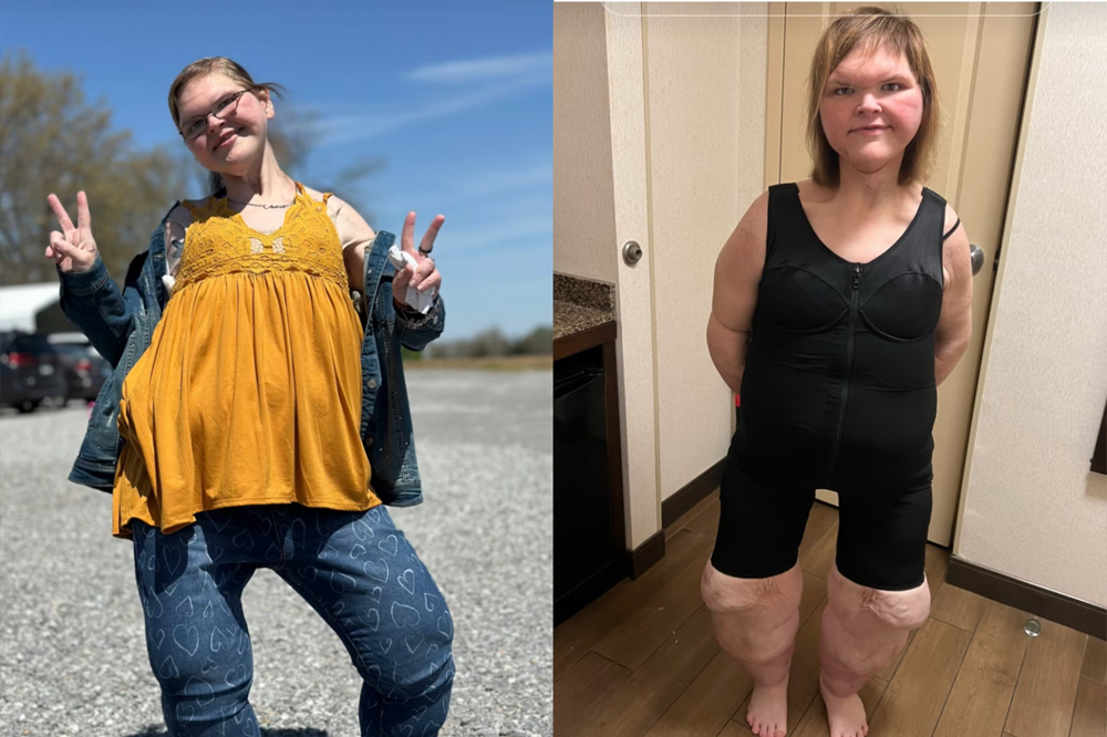 Tammy Slaton Weight Loss Story