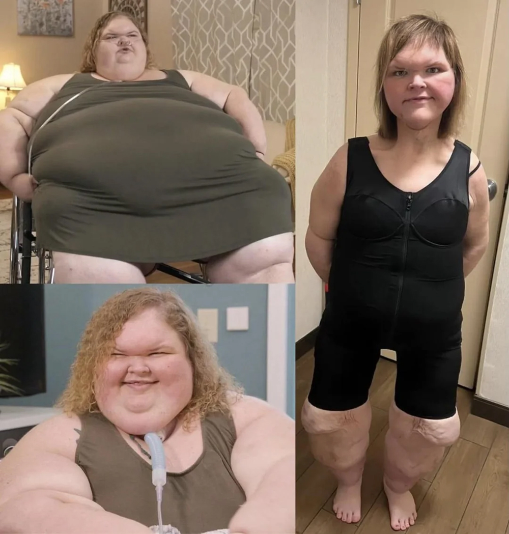 Tammy Slaton’s Weight Loss Journey: Surgery, Struggles, and a Stunning ...